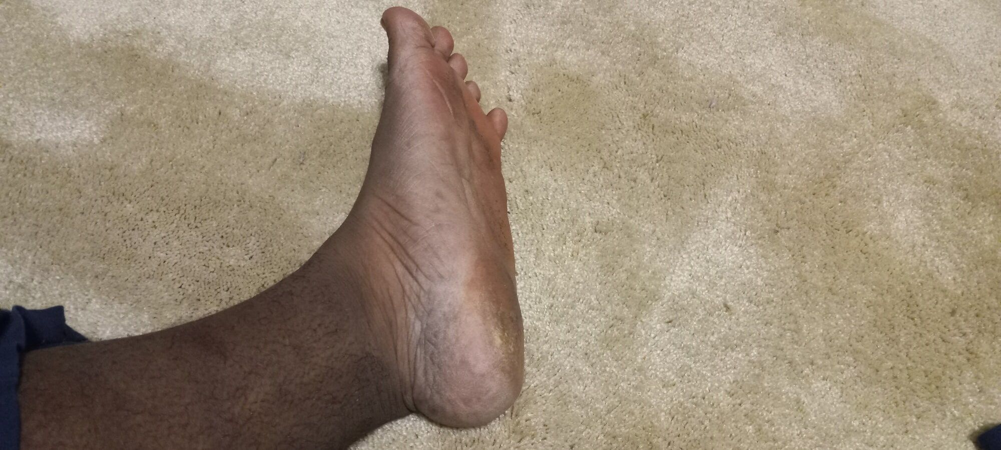 Pics of my Feet #11
