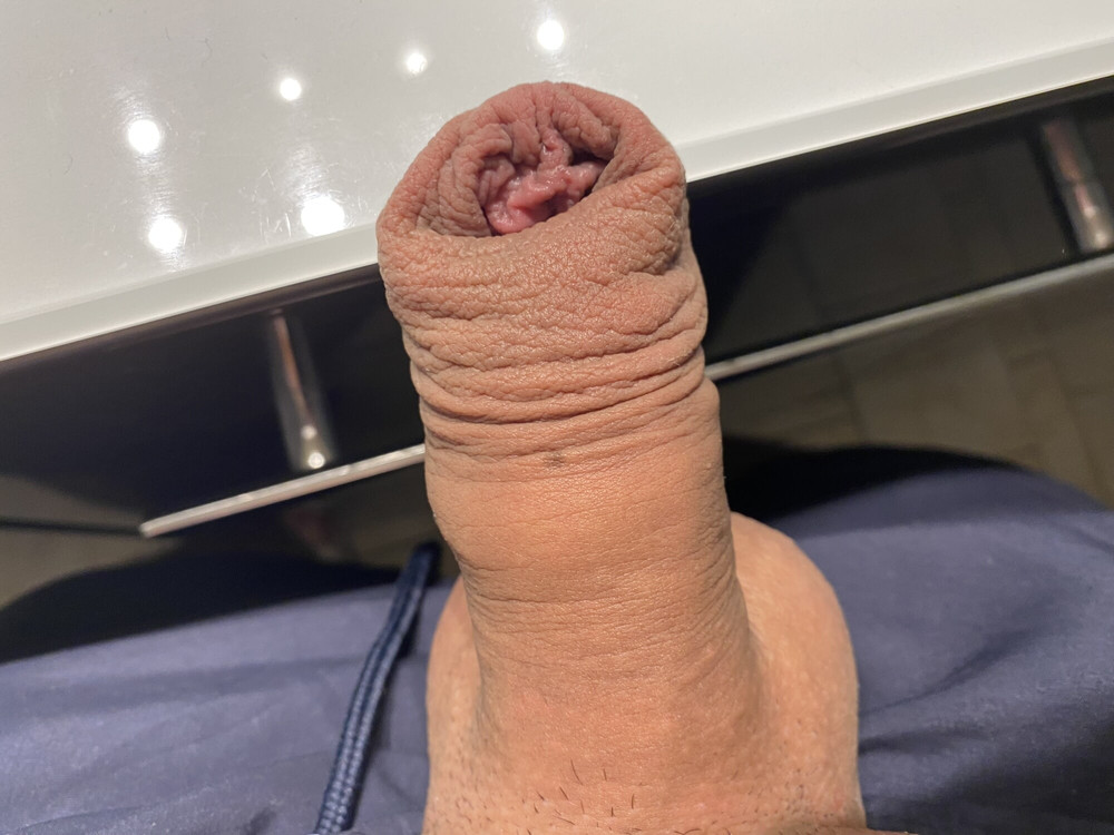 Loose foreskin porn #3
