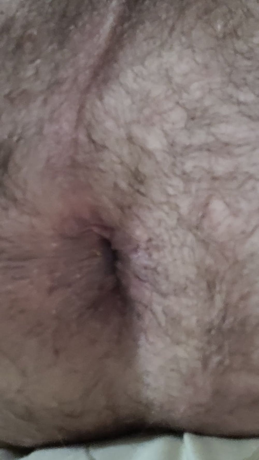 My hairy asshole #2