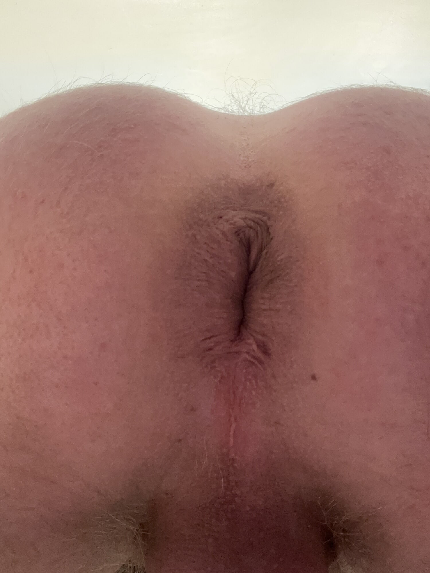 Anus 