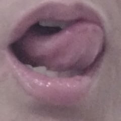 Teaser