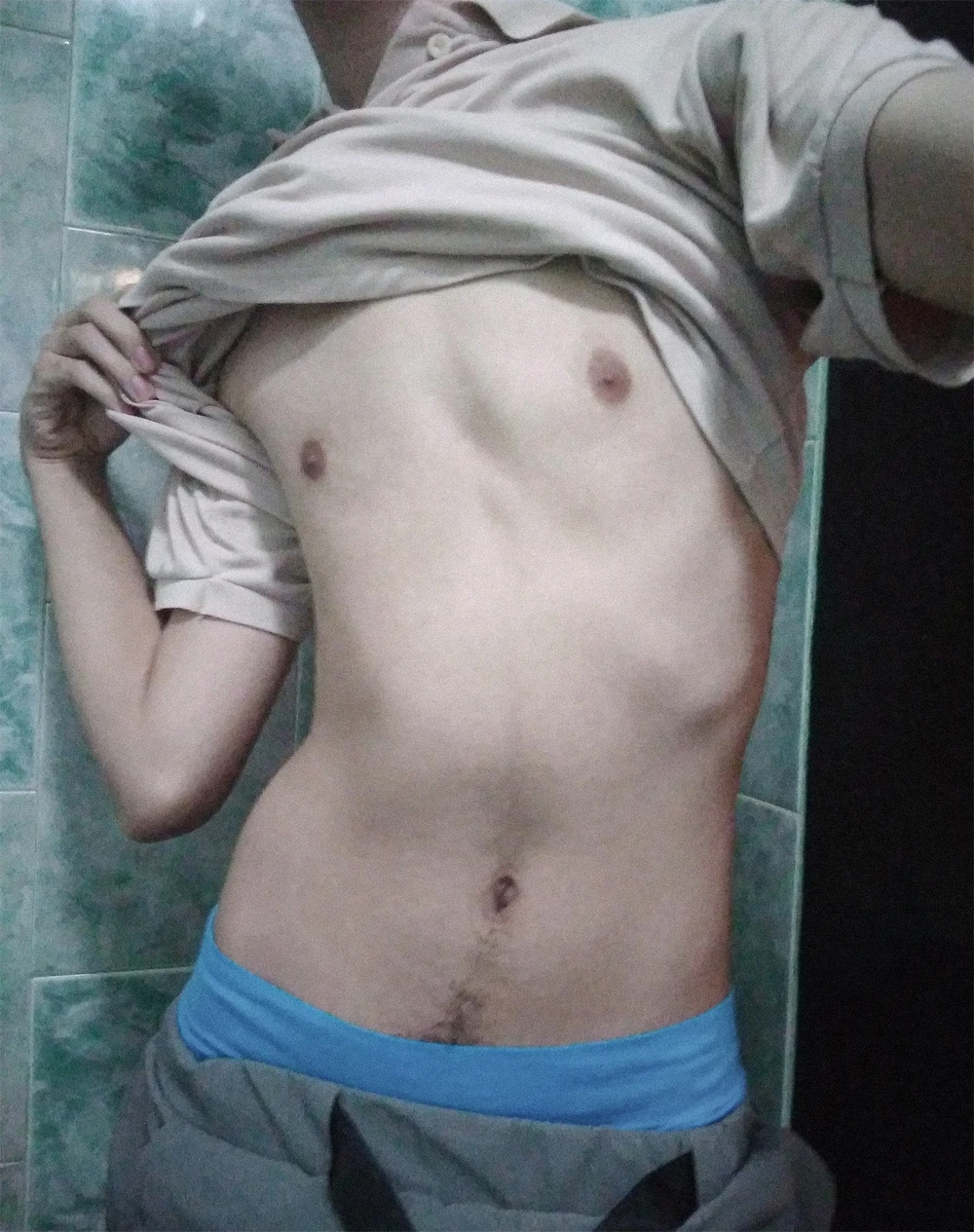 My skinny body 