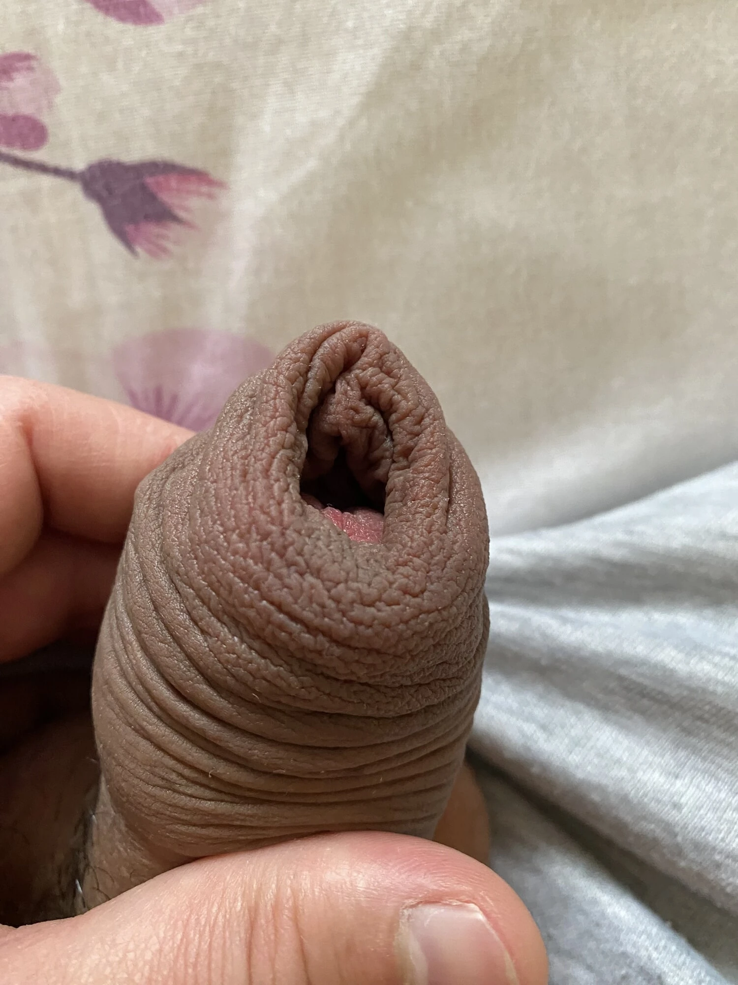 Foreskin hard stretching porn