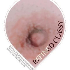 The nipple