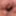 My foreskin #4