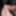Close up foreskin and glans #4