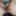 Young Chubby Girl Spreads Hairy Pussy Open on Webcam #33