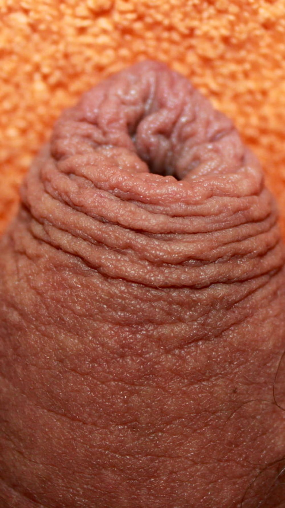 My foreskin