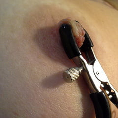 Tweezers on the breast