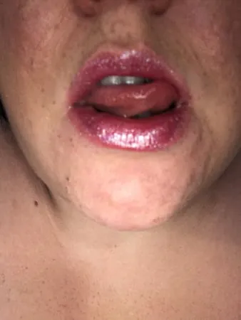 juicy lips         