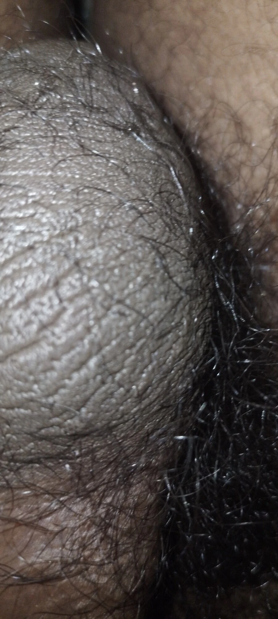 My Unerected Uncut Dick