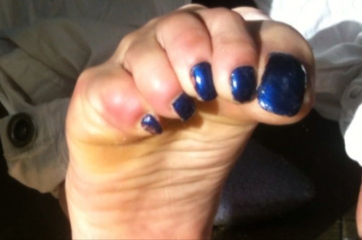 Blue toenails under sun ray #33