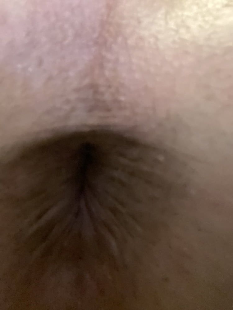 My gaped hole #14