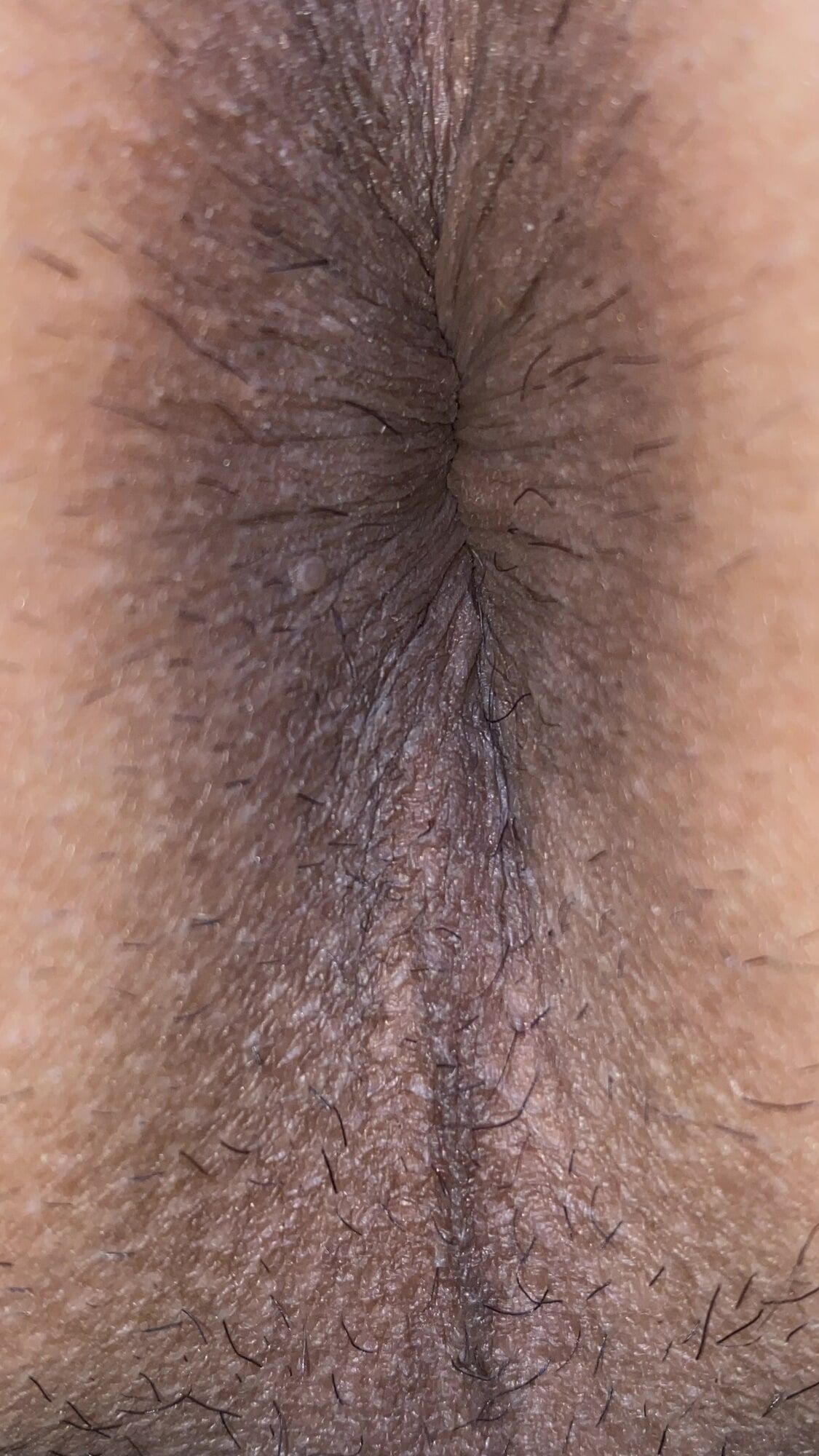 Close-up of a man's anus #20