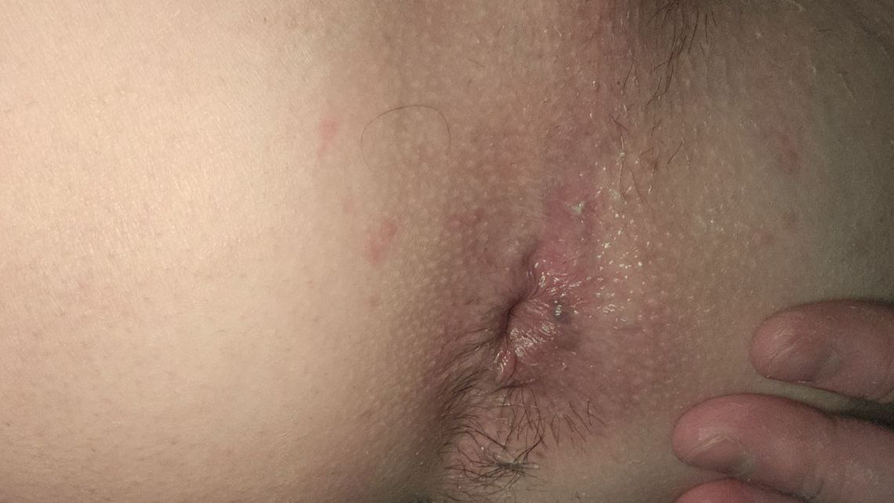 Naughty ass