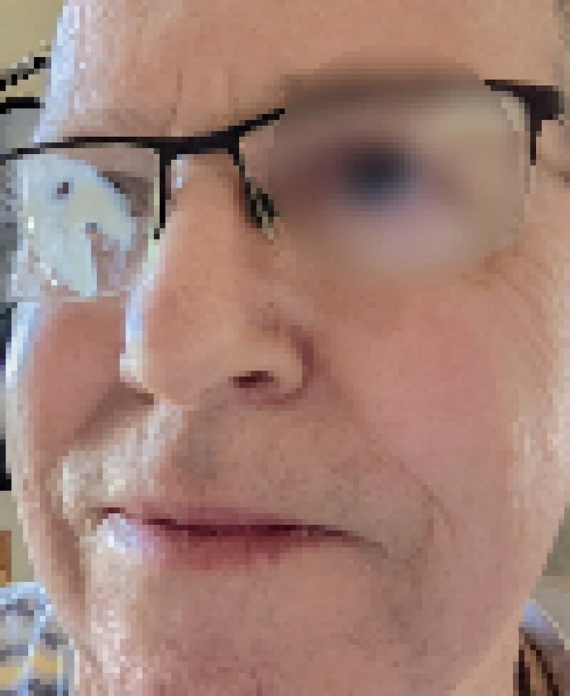 Cleaning my glasses  #3