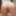 Cock-hardening body at age 62