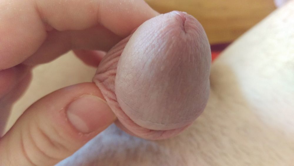 Penis banding session #2