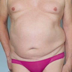 Quelques culottes