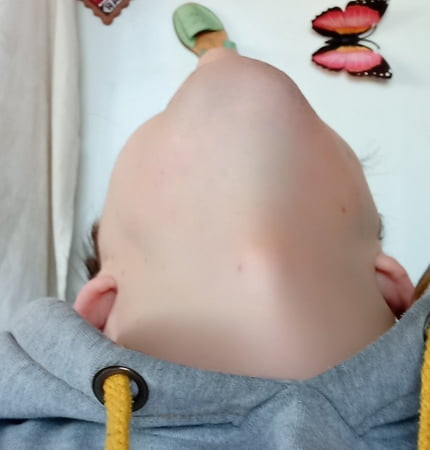 Boy Neck Fetish /Adams Apple