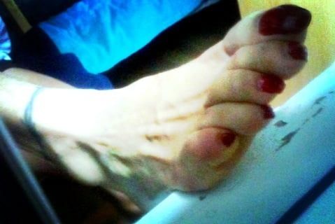 Asian ts feets, soles, toenails mix #28