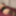 Teaser 3