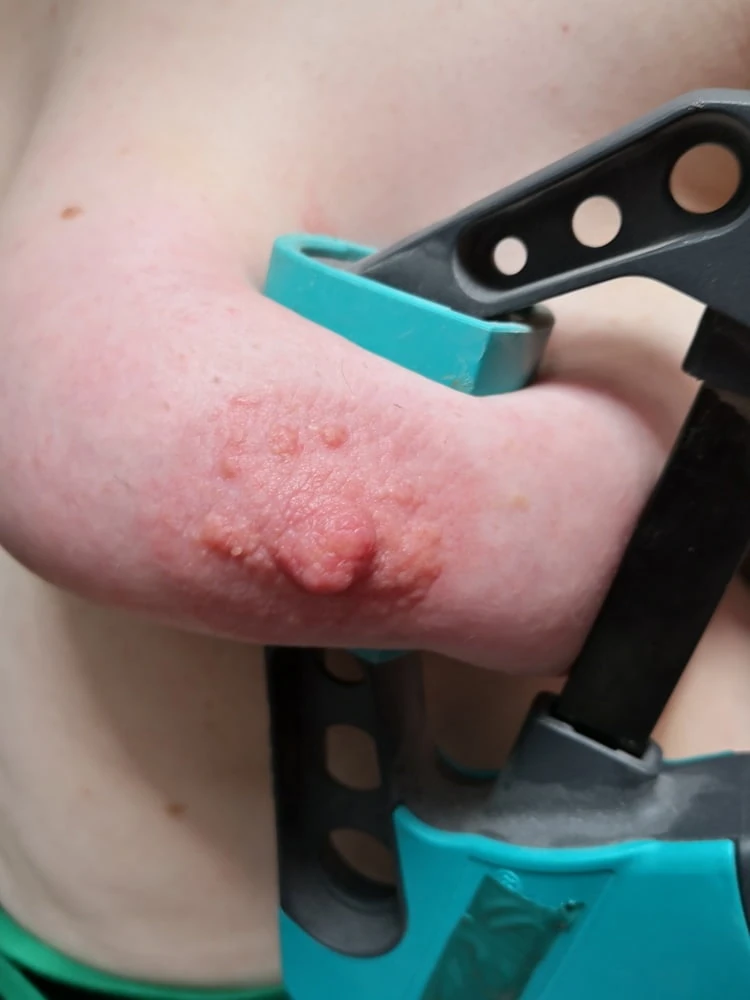 Tits squeezed with clamps  #2