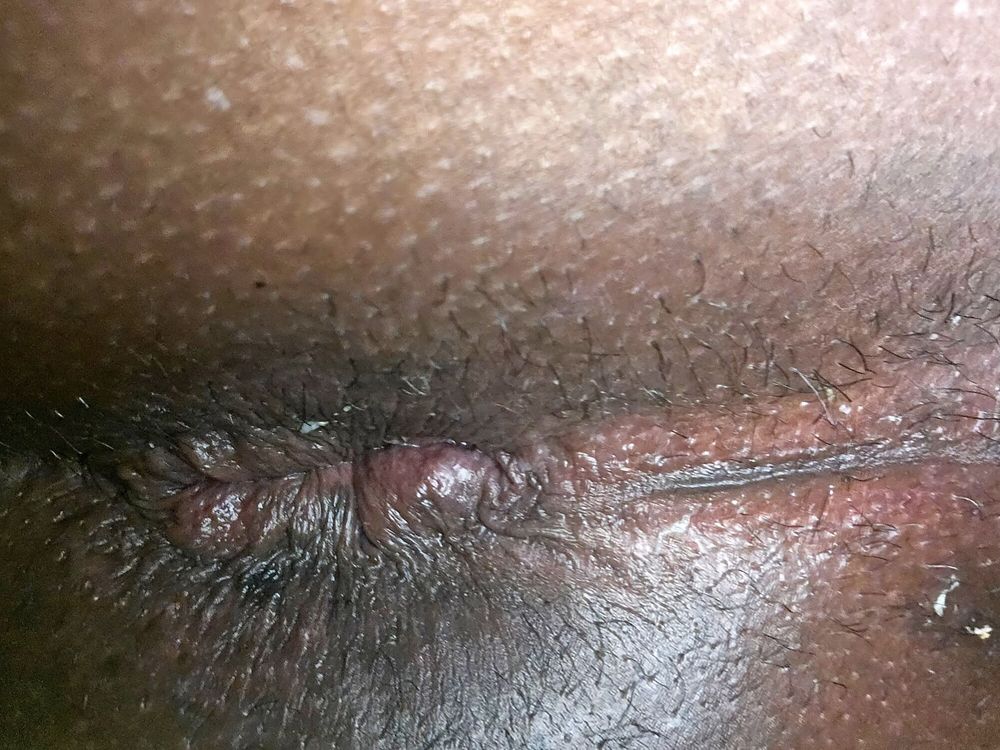 That hole 