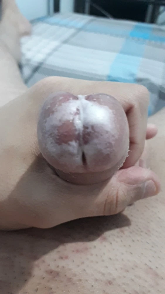 Wet Foreskin #8