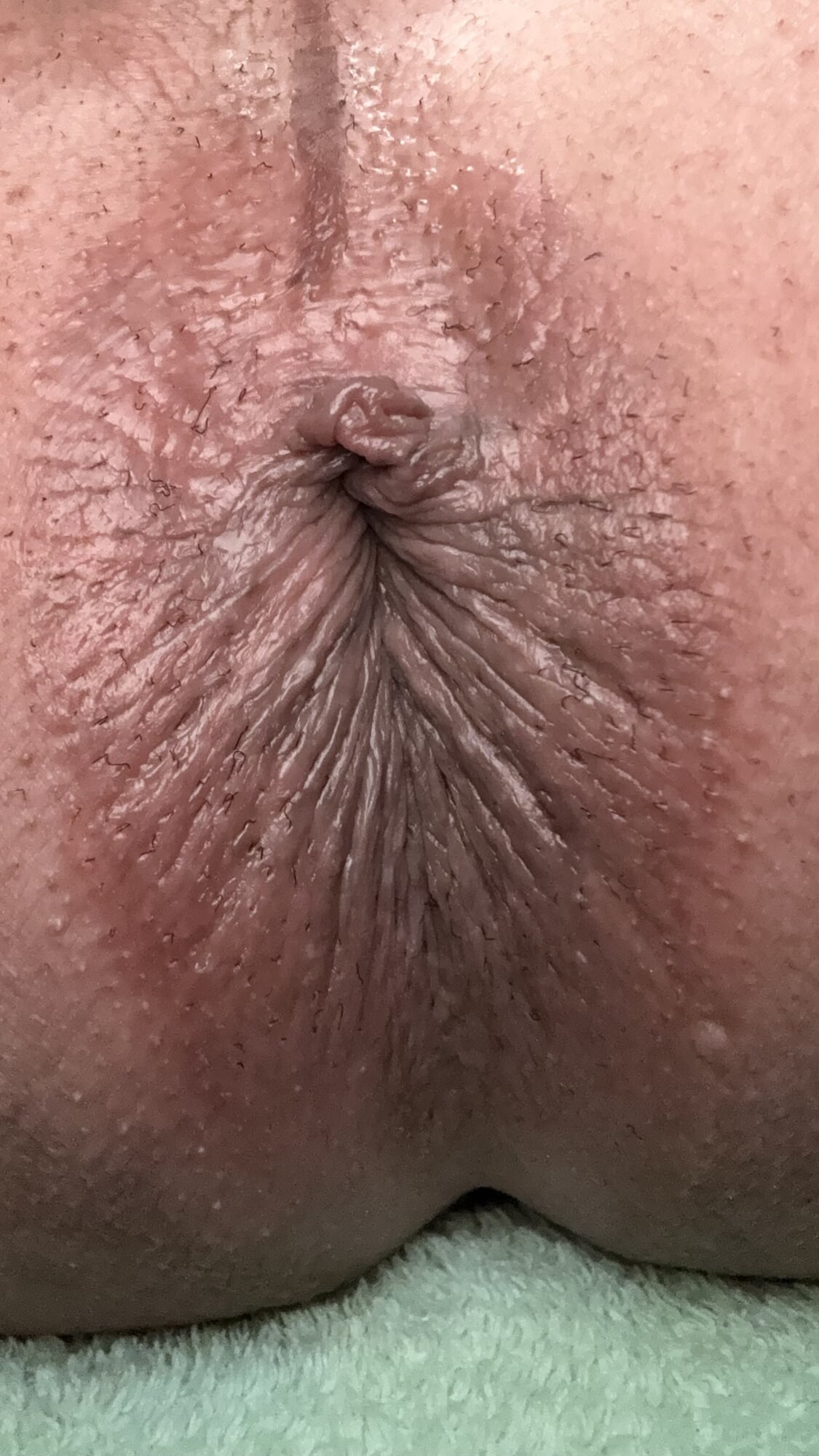Anal close-up