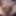 Fingering subincision deep #10
