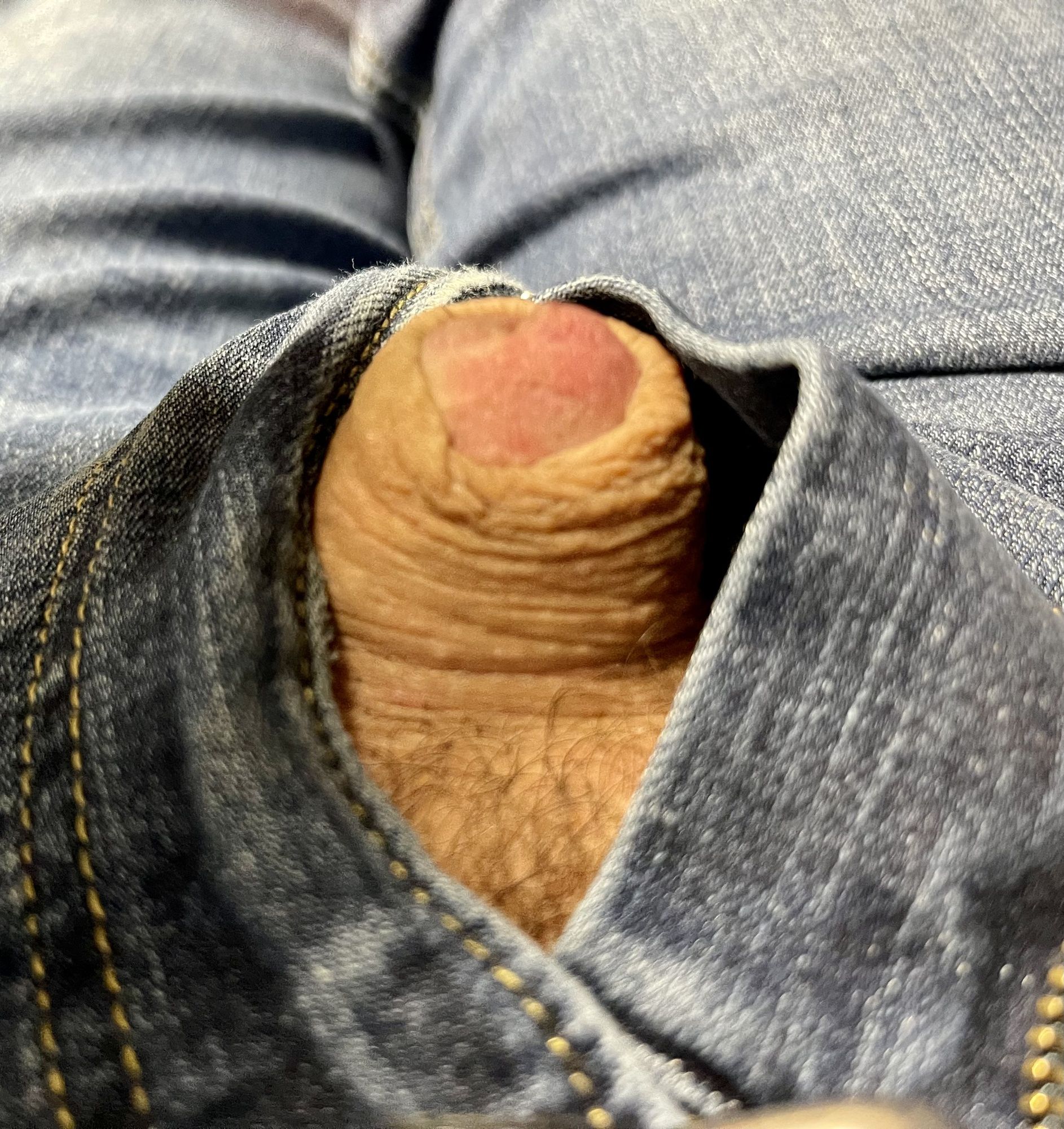 Tiny micro penis pic