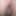 My gaped hole