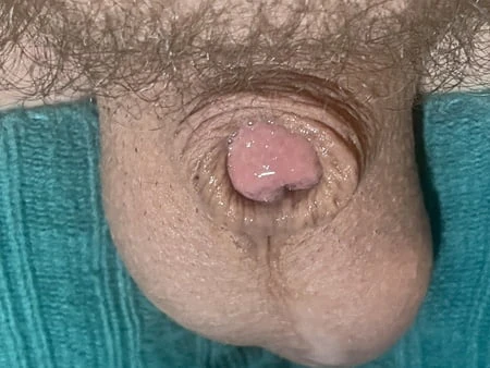 micropenis lady boy cock pic         