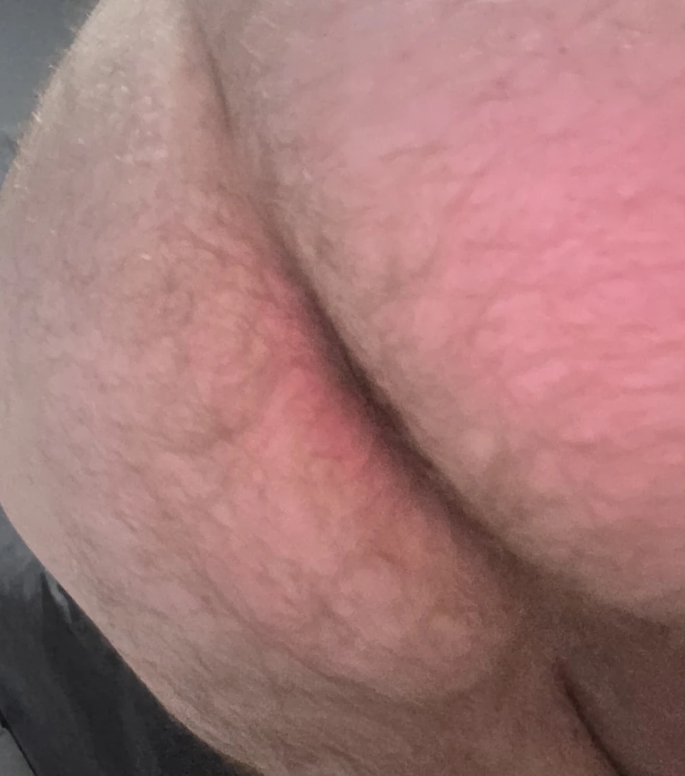 Tied balls and my hairy bum #4
