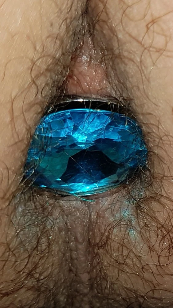 Plug anal #6