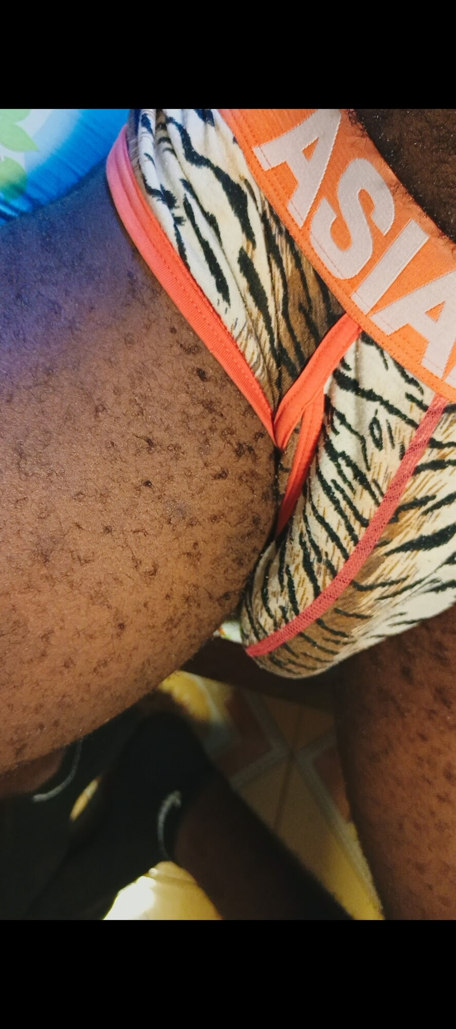 My hairy body  #4