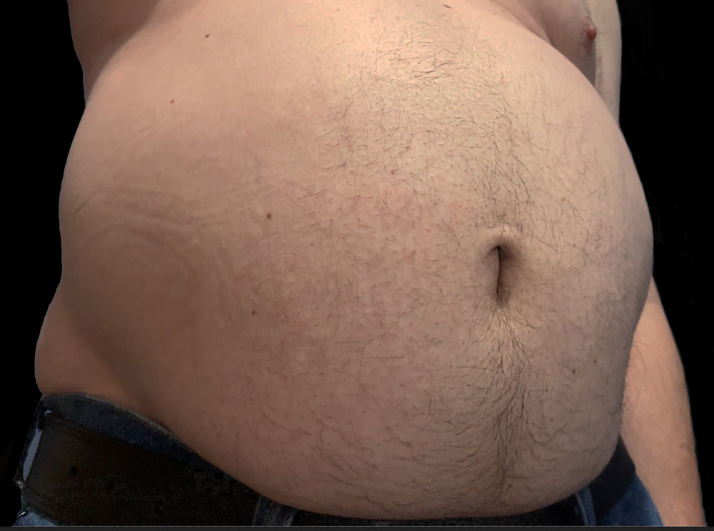 Ximd9000 Big Bloated Belly #27