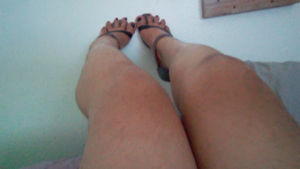 Overhanging toes, ankle straps, toe spreading.  #5