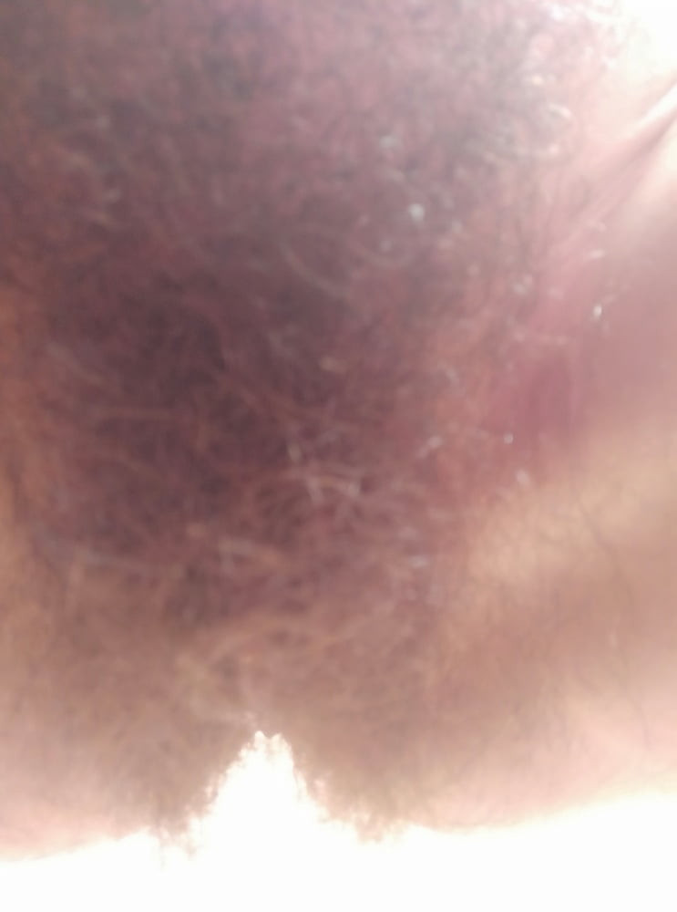 hairy #7