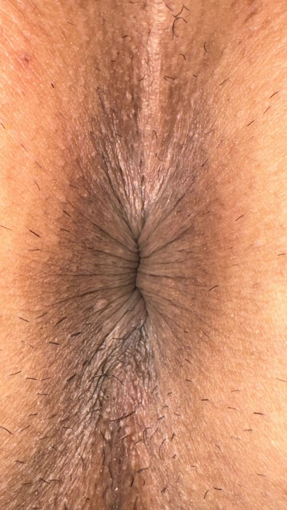 my anus #51