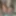 Micro cock, tiny penis pictures