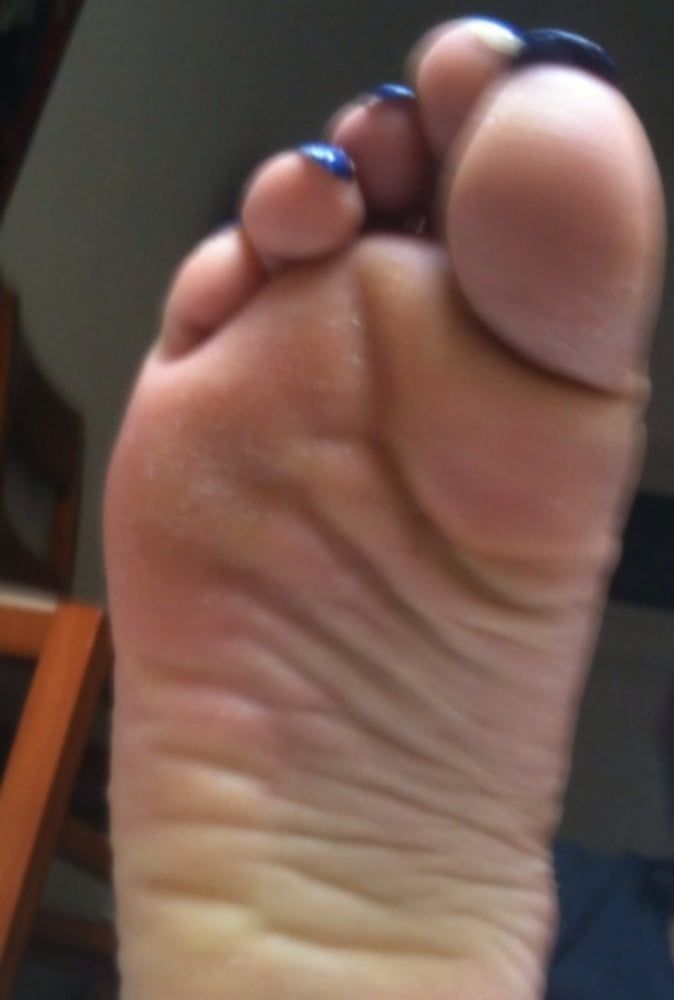 blue toenails and soles feet after day at beach  #20