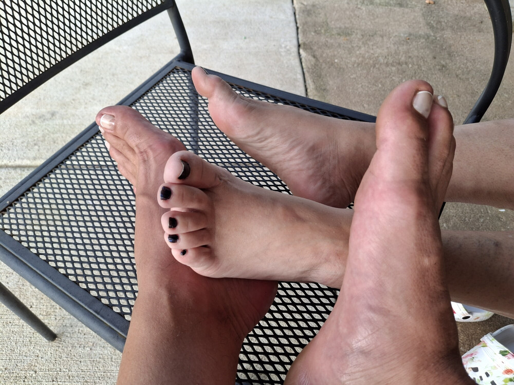 Foot comparison #7
