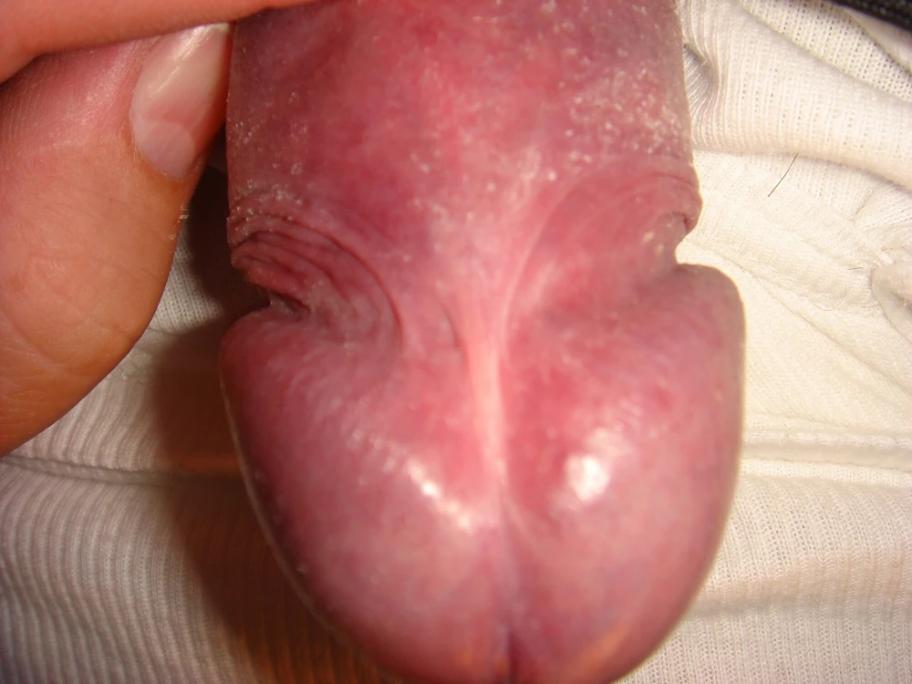 Micro penis #32