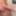 Dick