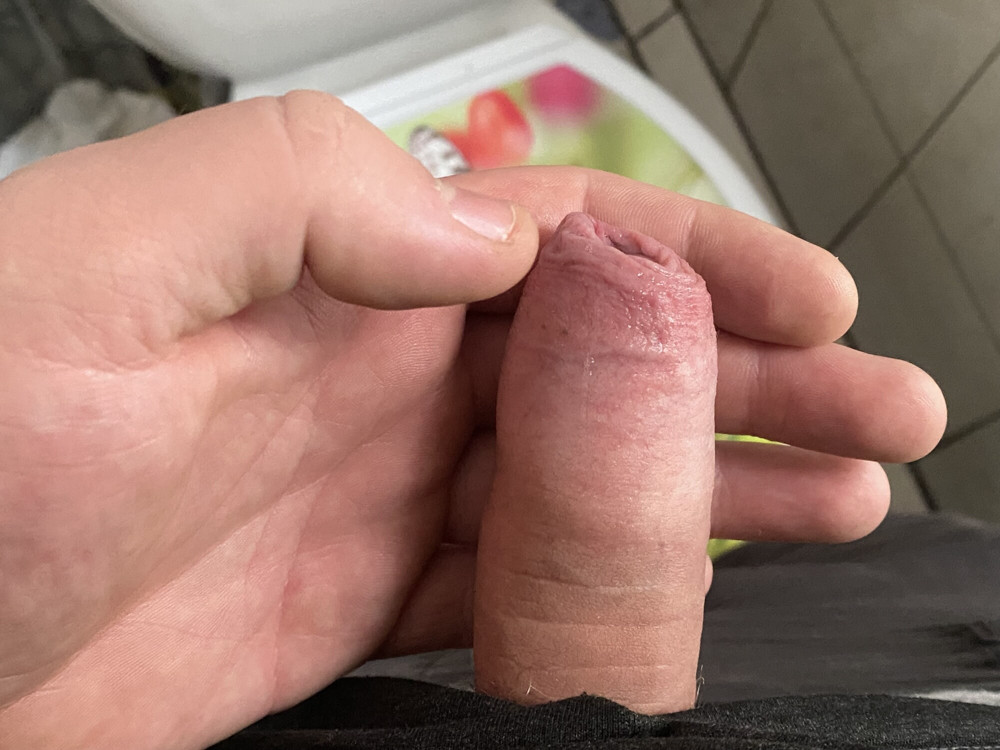 My so little penis 2 #4