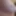 Breast Vacuum pumping