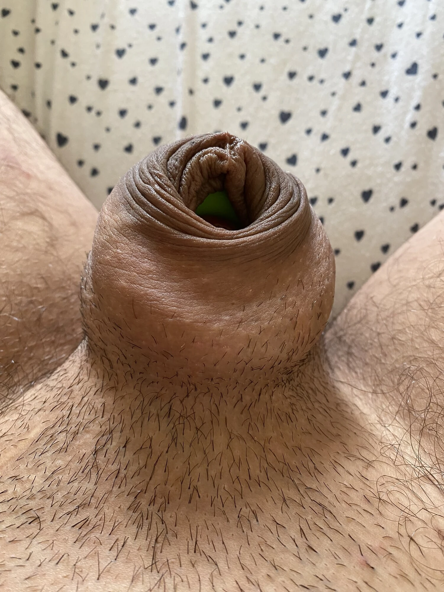 Donut ring foreskin porn