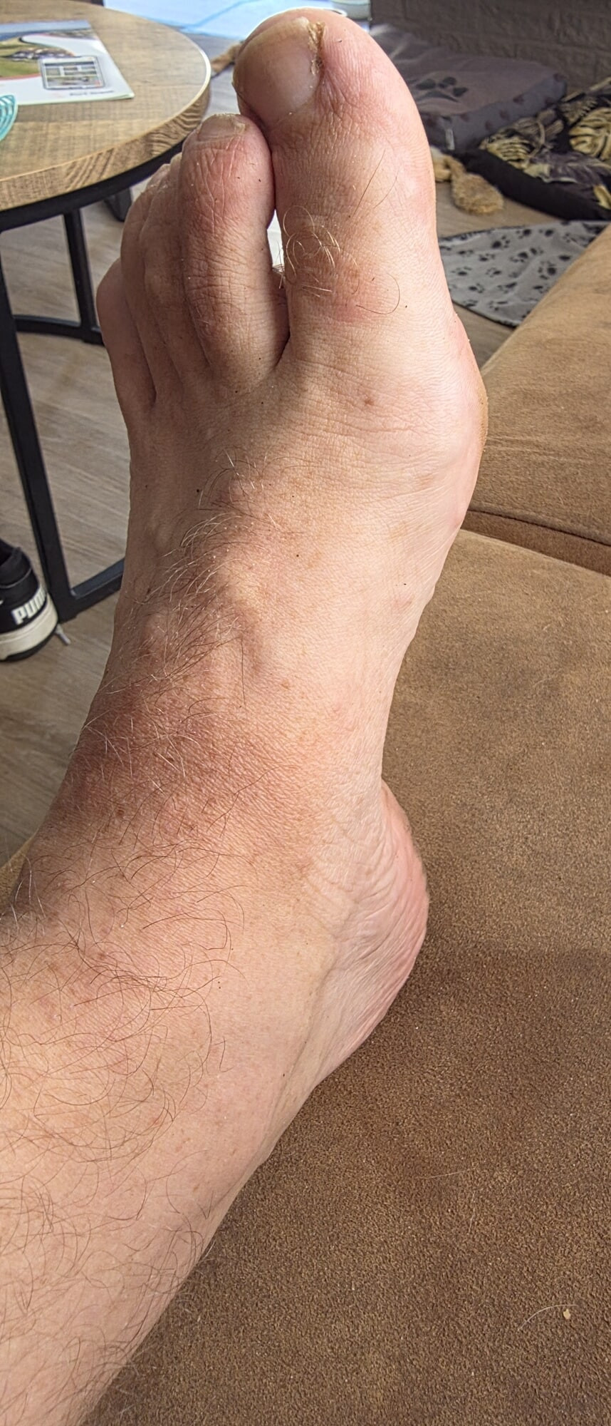 My feet #5